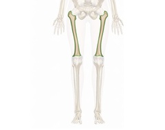 Pediatric Femur Fractures Treatments - Siiora.com
