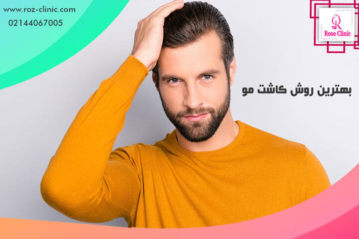 کاشت مو طبیعی - روش های پیوند مو طبیعی | کلینیک پوست و مو رز