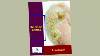 Don\u2019t Delay When It Comes To Using Fungus Supplement