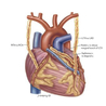 Bypass surgery cost in Delhi - Dr. Sujay Shad