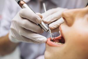 Why Do Dentists Not Use Lasers?