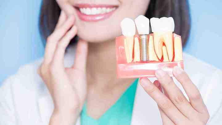 What to Expect from Dental Implant Surgery?