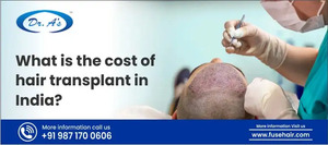 Hair Transplant Cost in India: Factors, Average Prices, and Considerations