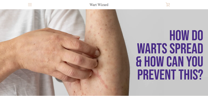 How Do Warts Spread and How Can You Prevent This?