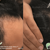 Discover Organic Care for Alopecia in Melbourne