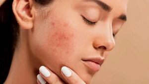 Experience Exceptional Skin Care: Best Dermatologist in Thousand Oaks