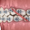 United States Orthodontics Market Growth, Analysis, Industry Forecast, &amp; Outlook Report 2024-2032