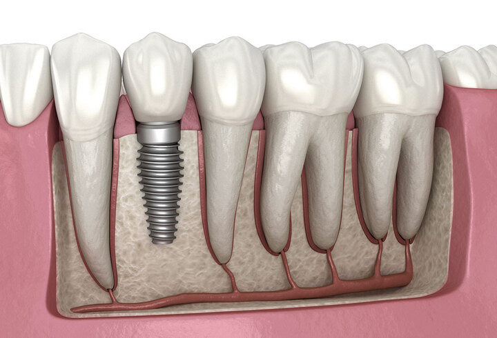 What is the Need for Cosmetic Dentistry?
