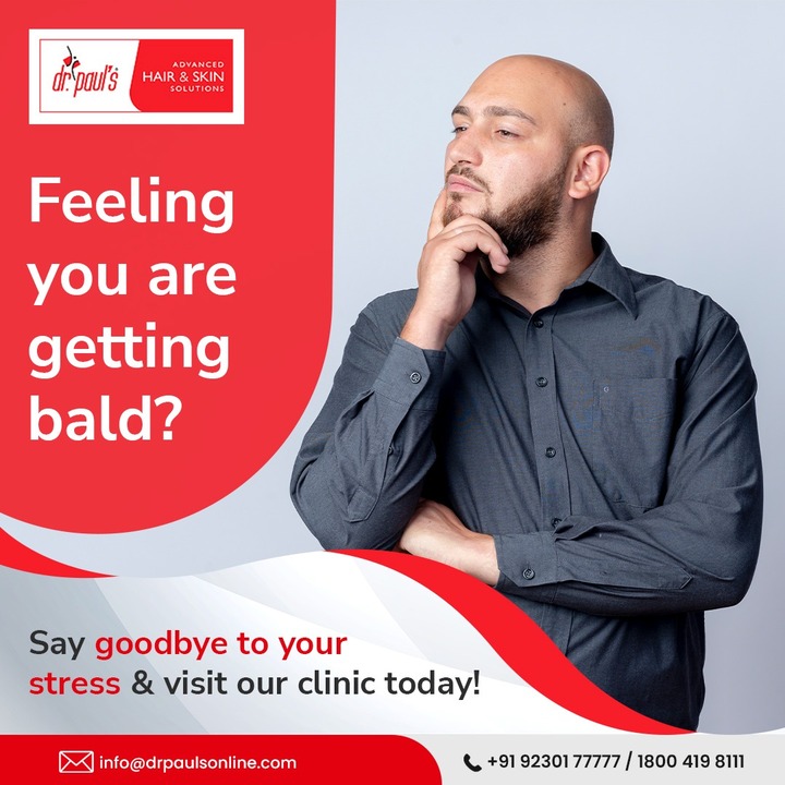 Hair Transplant vs. Other Hair Restoration Methods: Pros and Cons