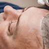 Hair Transplant Service