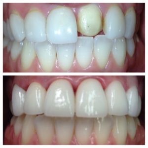 Relax While You Transform Your Smile: Sedation in Cosmetic Dentistry