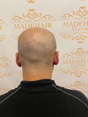 Check These Instances When You Might Need Pigmentation Therapy