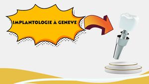 Gen\u00e8ve : l\u2019expertise en implantologie moderne de pr\u00e9cision