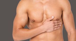 Gynecomastia Surgery: A Definitive Guide to Male Breast Reduction