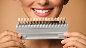 Gen\u00e8ve et les facettes dentaires esth\u00e9tiques, bon ou pas ?