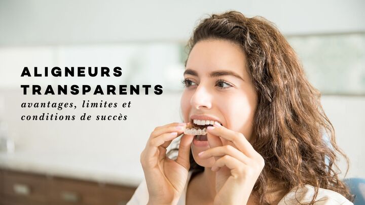 Aligneurs transparents – avantages, limites et conditions de succès