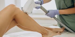 Understanding Varicose Vein Treatment in San Antonio