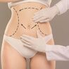 Tummy Tuck Surgery in Dubai