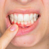 How Long Does A Tooth Infection Go Untreated?