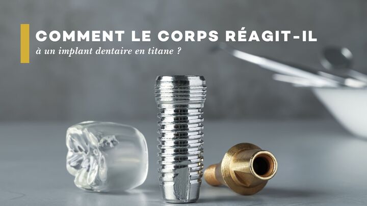 Comment le corps réagit-il à un implant dentaire en titane ?