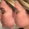 Glass Skin Facial