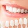 Are You a Good Candidate for Dental Implants?