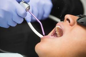 Do I Need a Dental Crown?