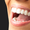 What is The Cost of a Single Tooth Implant?