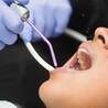 Do I Need a Dental Crown?