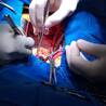 Heart Surgery Doctor in India - Dr. Sujay Shad