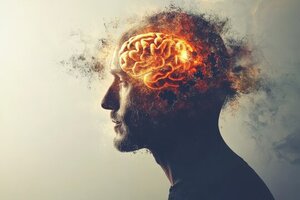 How Overthinking Impacts Your Mental Health