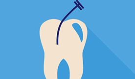 Root Canal vs. Extraction: Making the Best Choice for Your Dental Health