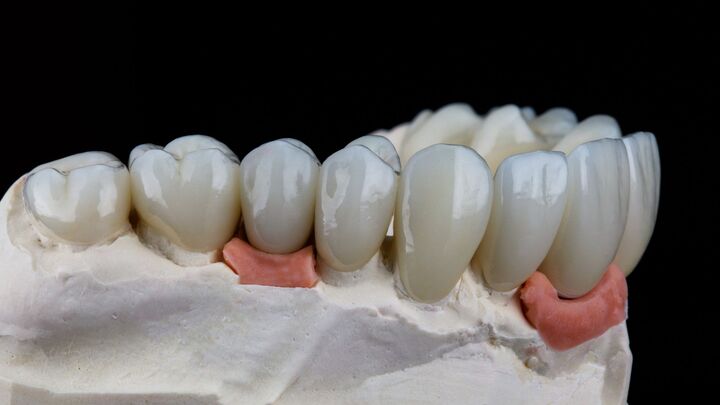 Quels sont les avis des patients sur Dentisterie esthétique Genève ?