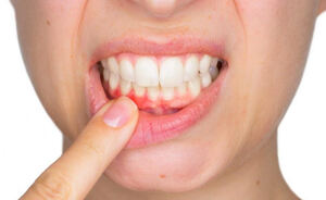 What Are the Significant Symptoms of a Tooth Infection Spreading to the Rest of the Body?