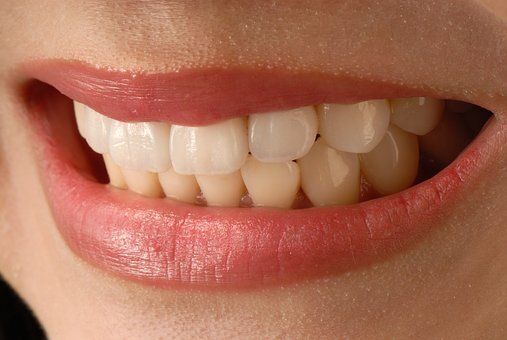 Teeth Whitening in Dallas: Which Method Is Right for You?