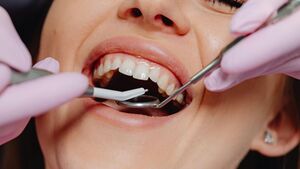 Mythe ou r\u00e9alit\u00e9 : soins gingivaux holistiques, risques et pr\u00e9vention