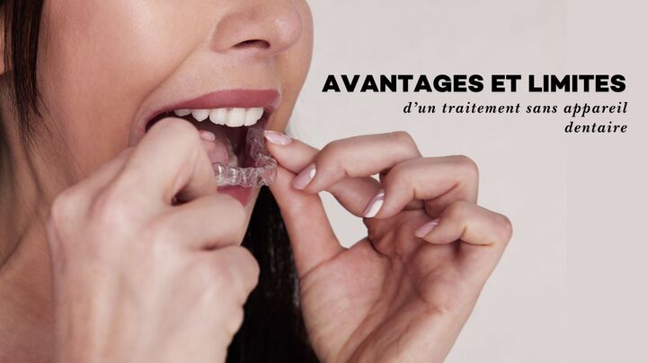 Avantages et limites d’un traitement sans appareil dentaire