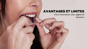 Avantages et limites d\u2019un traitement sans appareil dentaire