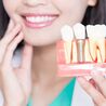 Tout savoir sur les implants dentaires et leur entretien