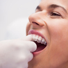 Prosper Invisalign: The Clear Path to a Perfect Smile