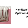 Hamilton&#039;s Dental Implant Options: A Comprehensive Overview