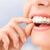 Top 5 Major Benefits of Invisalign