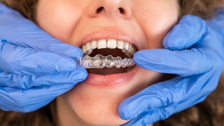 Achieve a Confident, Straighter Smile with Invisalign in Geneva