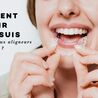 Comment savoir si je suis candidat aux aligneurs sur mesure ?