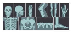 What Are the Benefits of Digital X-ray At Home?