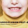 Une surocclusion peut-elle entra\u00eener des douleurs cervicales ou faciales ?