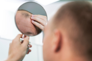 Simple Steps to Control and Prevent Hair Loss