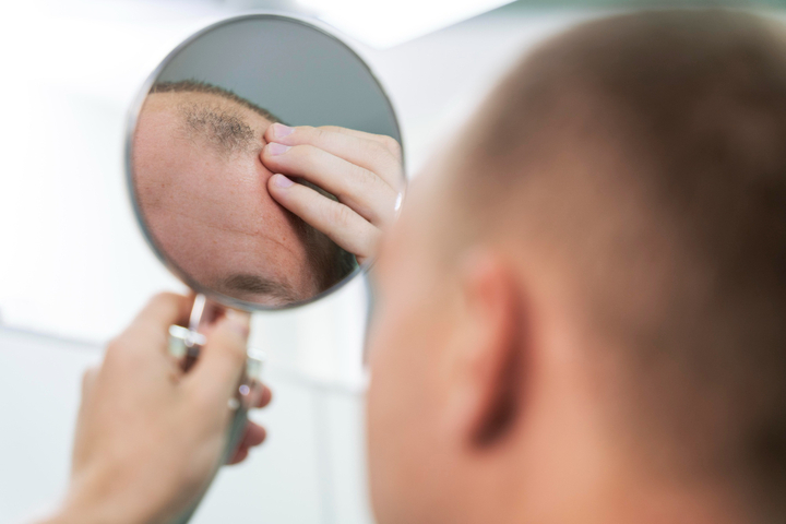 Simple Steps to Control and Prevent Hair Loss