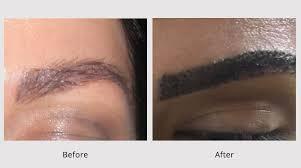 Reason of Thinning Eyebrows or Sparse