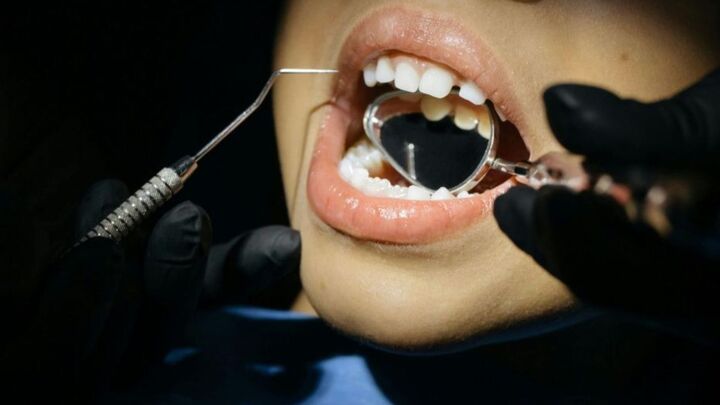 Fermeture d’un espace entre dents : solutions esthétiques modernes en Suisse